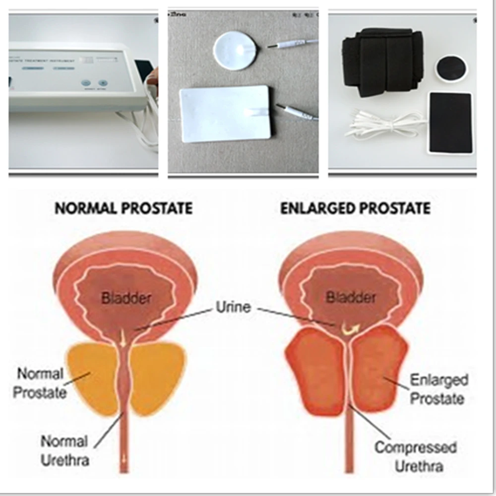 強力な前立腺マッサージ器 パルス振動磁気療法器具 男性用 前 - Therapy Health And Wellness のレビューと価格